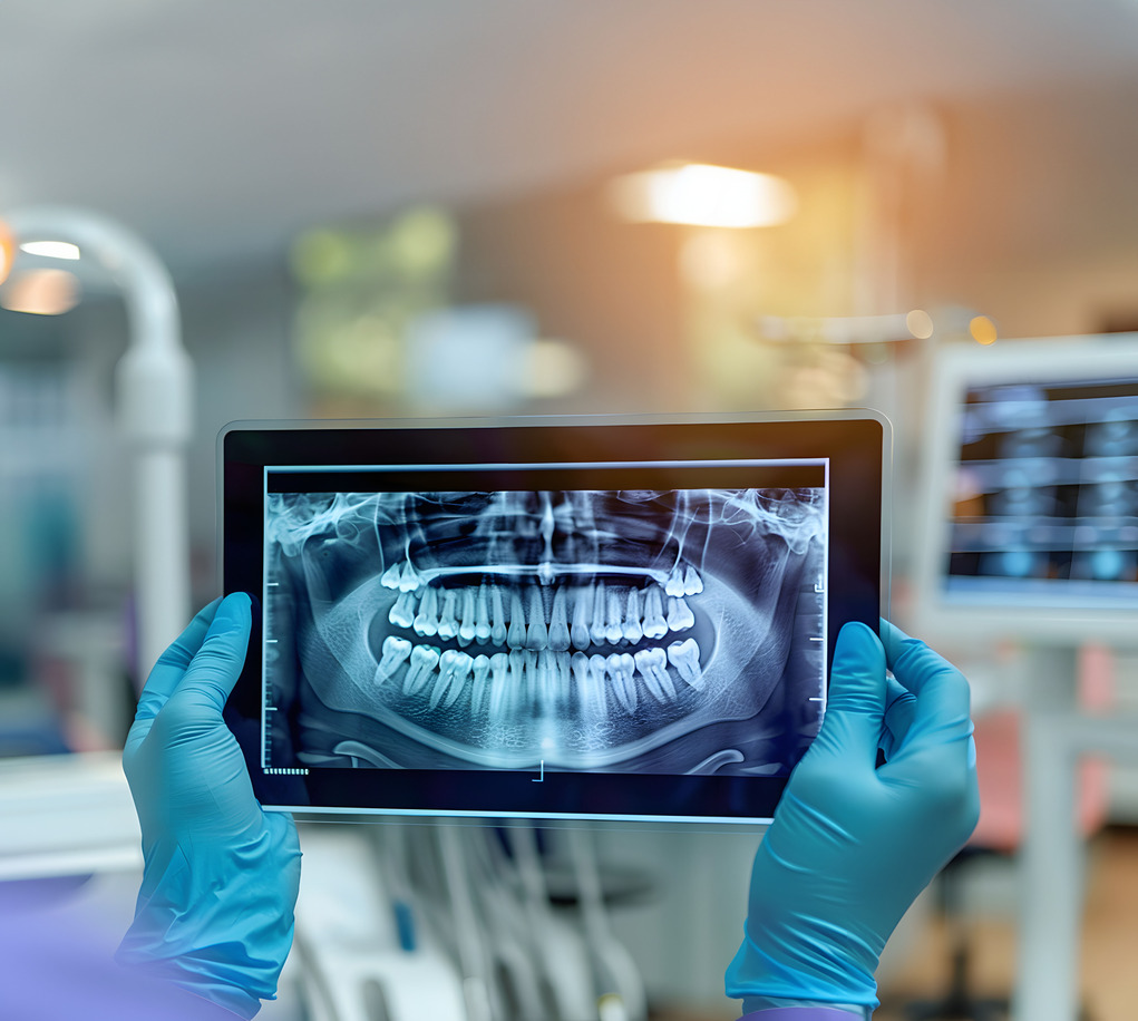 Radiologia dentale
