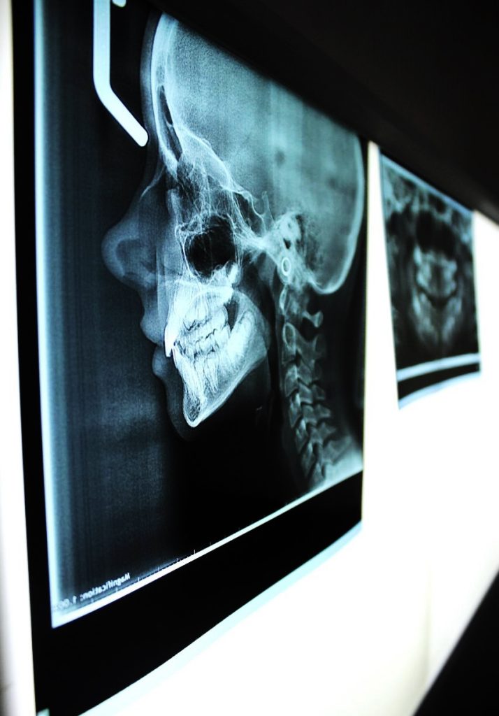 radiografie - esami radiografici