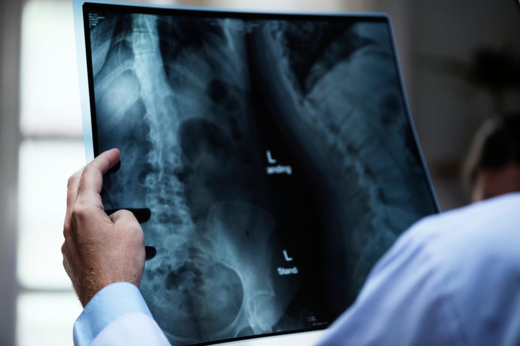 Visite specialistiche ortopedia e traumatologia - radiografie scheletriche