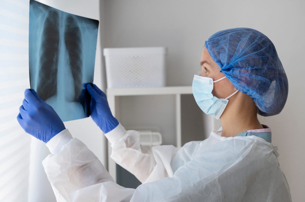 radiografia di controllo