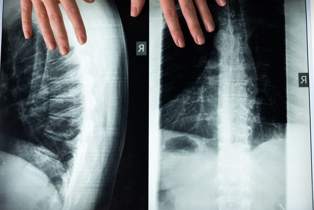 Radiografie della colonna vertebrale esaminate dal medico